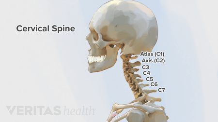 Image of a spine with segments C1-C7 labeled