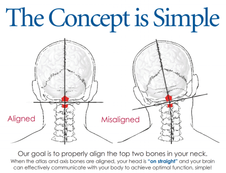 The Concept is Simple. Our goal is to properly align the top two bones in your neck. When the atlas and axis bones are aligned, your head is "on straight" and your brain can effectively communicate with your body to achieve optimal function, simple!